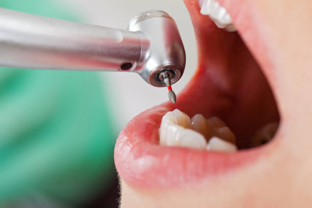 Best Emergency Tooth Extraction  in El Paso De Robles, CA